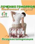 Лазерное лечение геморроя в клинике. 