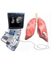 УЗИ легких 